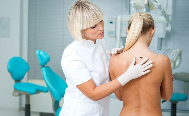 como prevenir o cancer de pele Como prevenir o câncer de pele