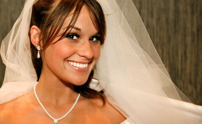 Dentes brancos para o dia do casamento dentes brancos casamento Dentes brancos para o dia do casamento