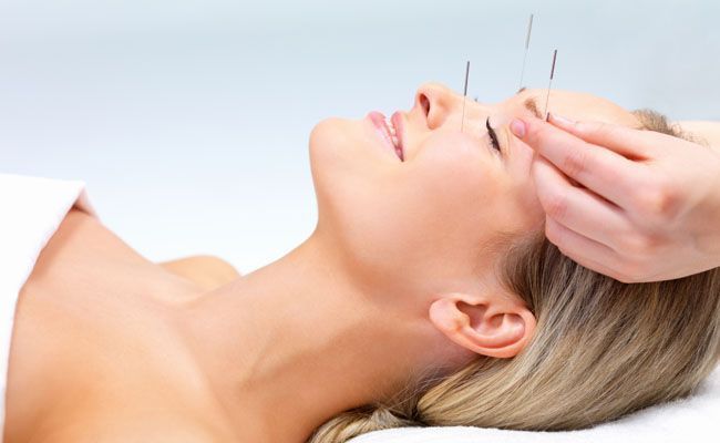 acupuntura-10-beneficios-surpreendentes-para-sua-saude