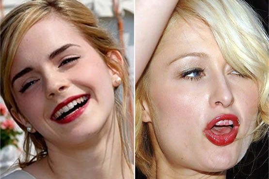 Depois de aplicar o batom, confira se não manchou nada para não fazer feio como Emma Watson e Paris Hilton e sair por aí distribuindo sorrisos com batom nos dentes
