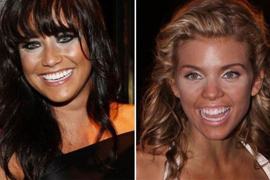 Outro problema que a escolha errada do corretivo pode causar é o efeito panda invertido. Fernanda Vasconcellos e Annalynne Mccord tentaram esconder as olheiras, mas o resultado foi desastroso
