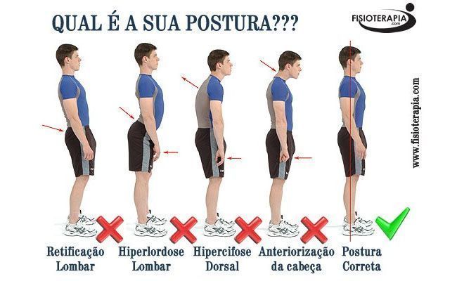 Foto: Reprodução / Fisioterapia.com