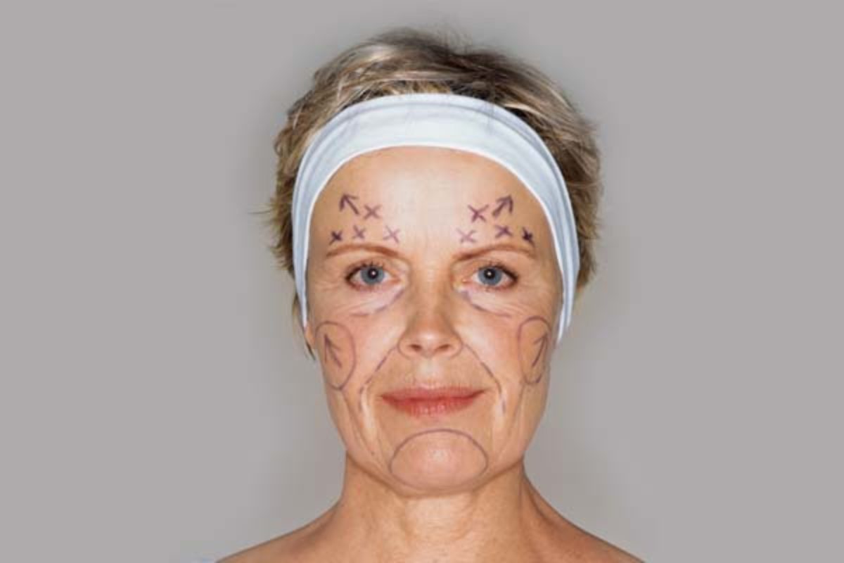 mulher realizando cirurgia plástica