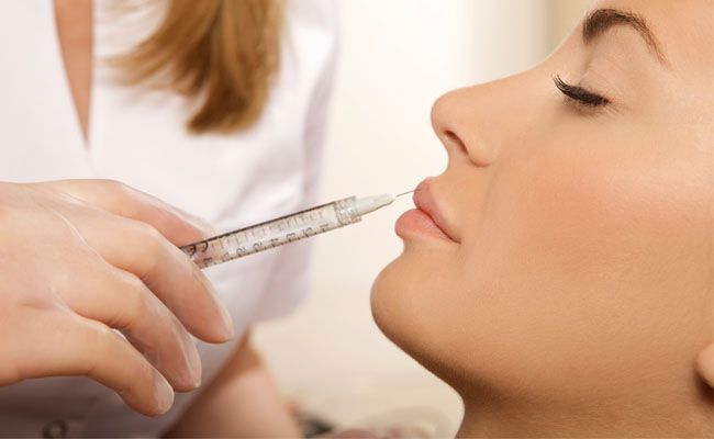 botox-antes-dos-30