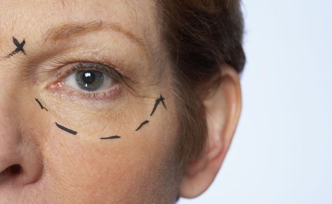 diferentes-tipos-de-cicatrizes