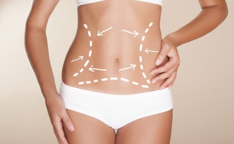 Lipoaspiração: conheça os principais tipos de lipo