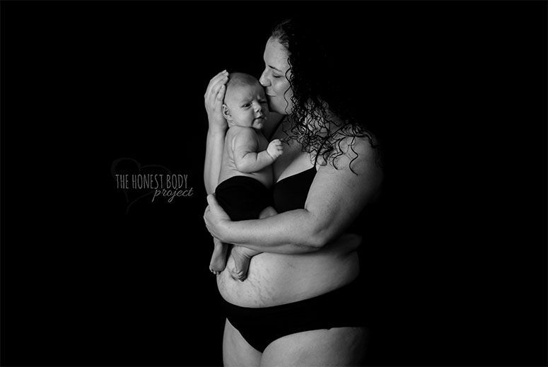 Foto: Reprodução / Natalie McCain / The Honest Body Project