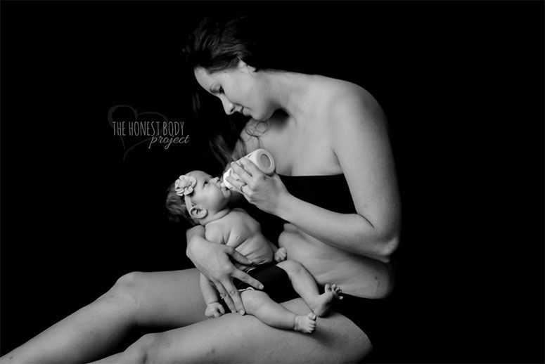 Foto: Reprodução / Natalie McCain / The Honest Body Project