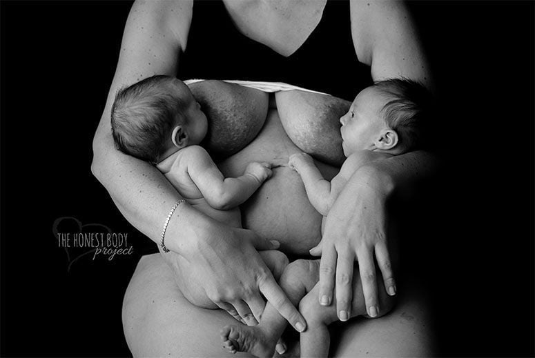 Foto: Reprodução / Natalie McCain / The Honest Body Project