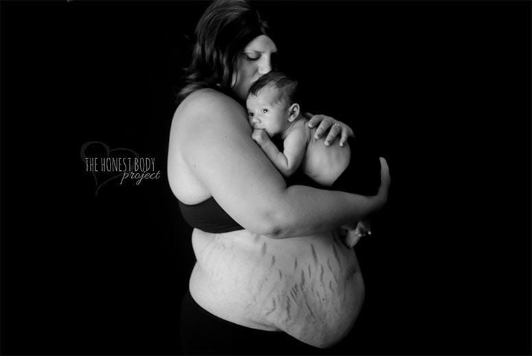 Foto: Reprodução / Natalie McCain / The Honest Body Project