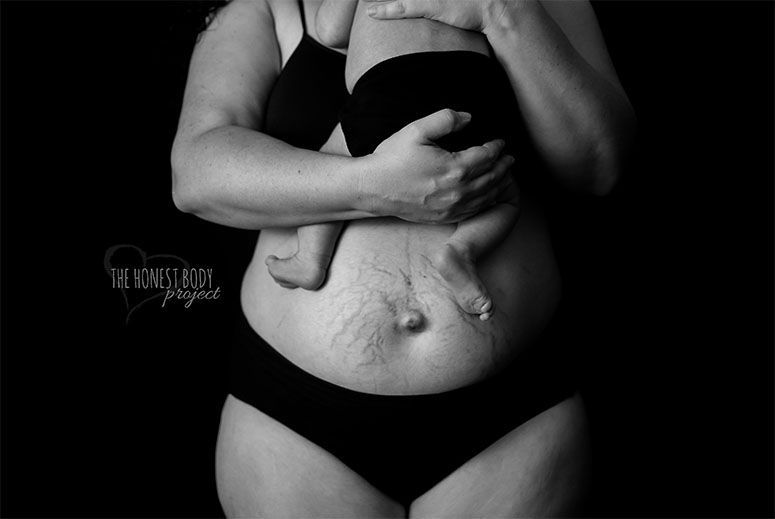 Foto: Reprodução / Natalie McCain / The Honest Body Project