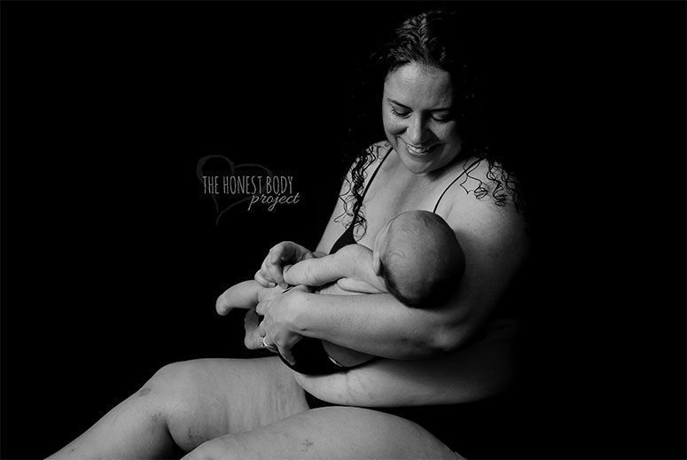 Foto: Reprodução / Natalie McCain / The Honest Body Project