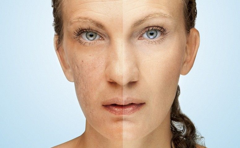 Como clarear a pele: tratamentos e produtos contra manchas