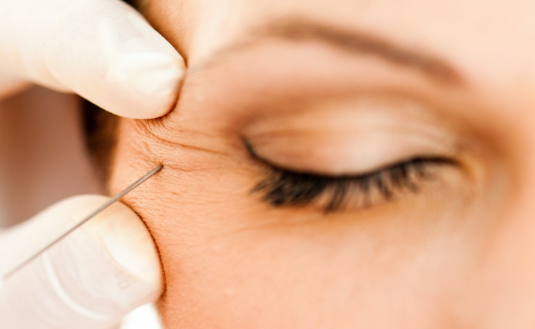 Botox: saiba mais sobre o procedimento e os usos além da estética