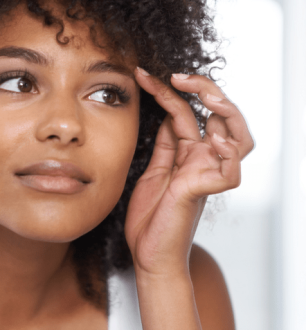 4 fatores que causam caspa na sobrancelha e como tratá-la