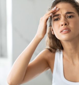 5 causas de espinhas na testa e dicas para uma pele saudável