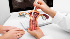 5 sintomas de pólipo no útero para se atentar e procurar o ginecologista