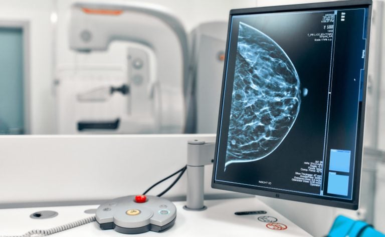 Mamografia: o que é, quando é indicada e como o exame funciona