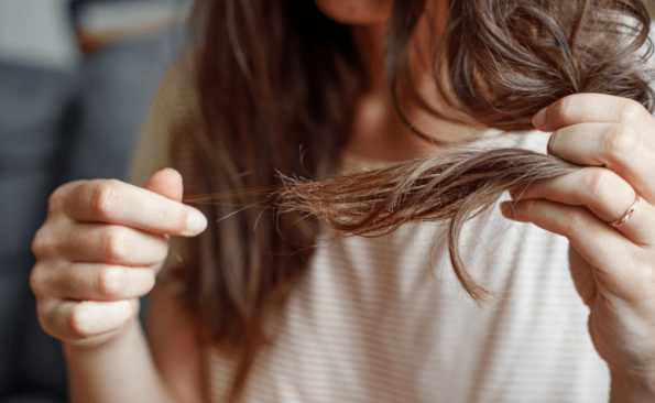 Cabelo caindo muito: as 10 principais causas e o que fazer!