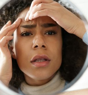 Dermatologista esclarece as principais dúvidas sobre cravos no rosto